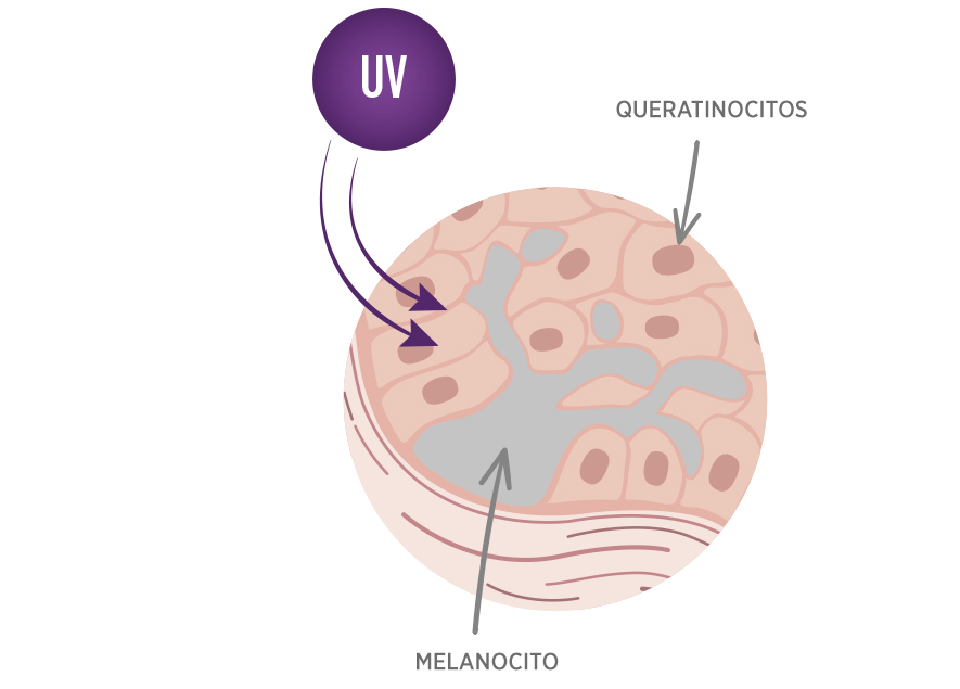 PIGMENT EXPERT actúa en las 4 fases de la formación de una mancha