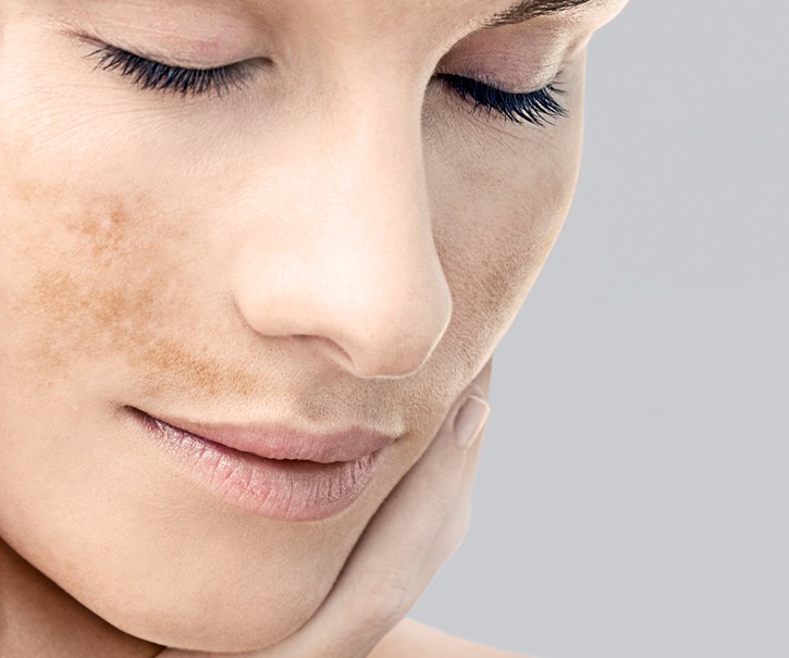 FotoUltra ISDIN Spot Prevent