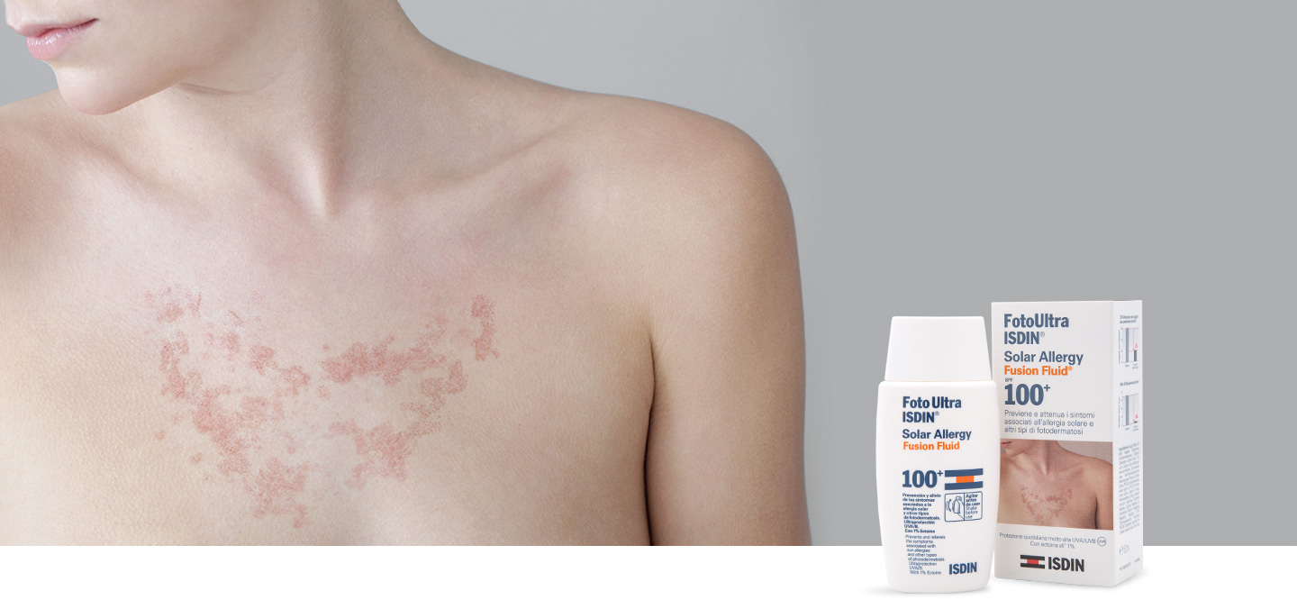FotoUltra ISDIN Solar Allergy