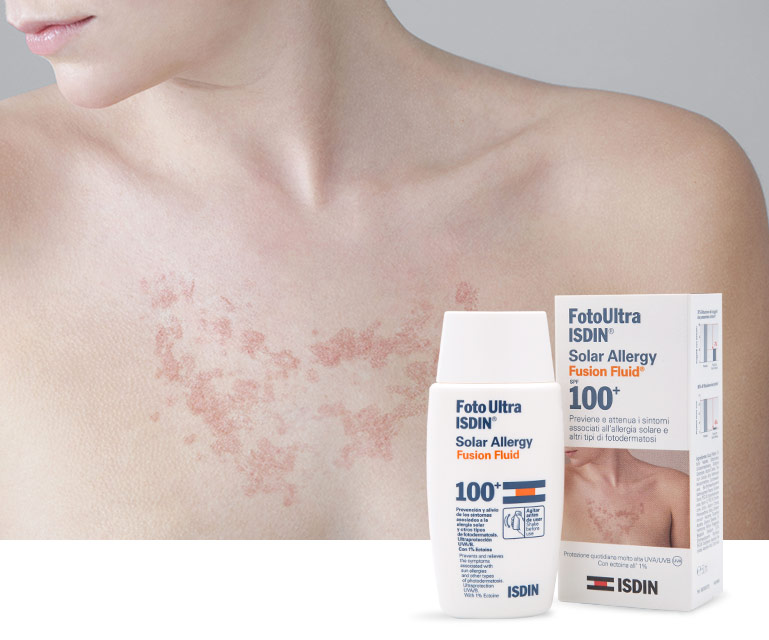 FotoUltra ISDIN Solar Allergy