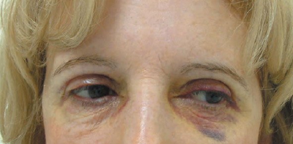 isdinceutics k-ox eyes