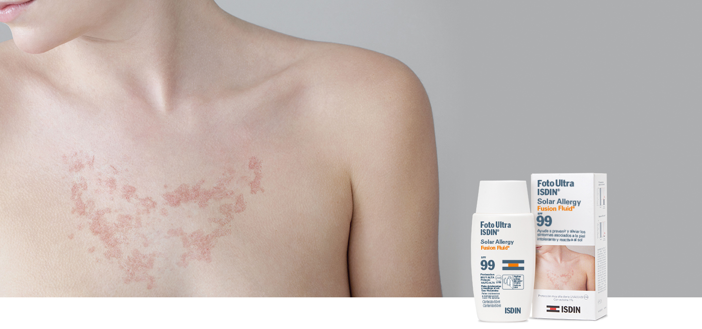FotoUltra ISDIN Solar Allergy
