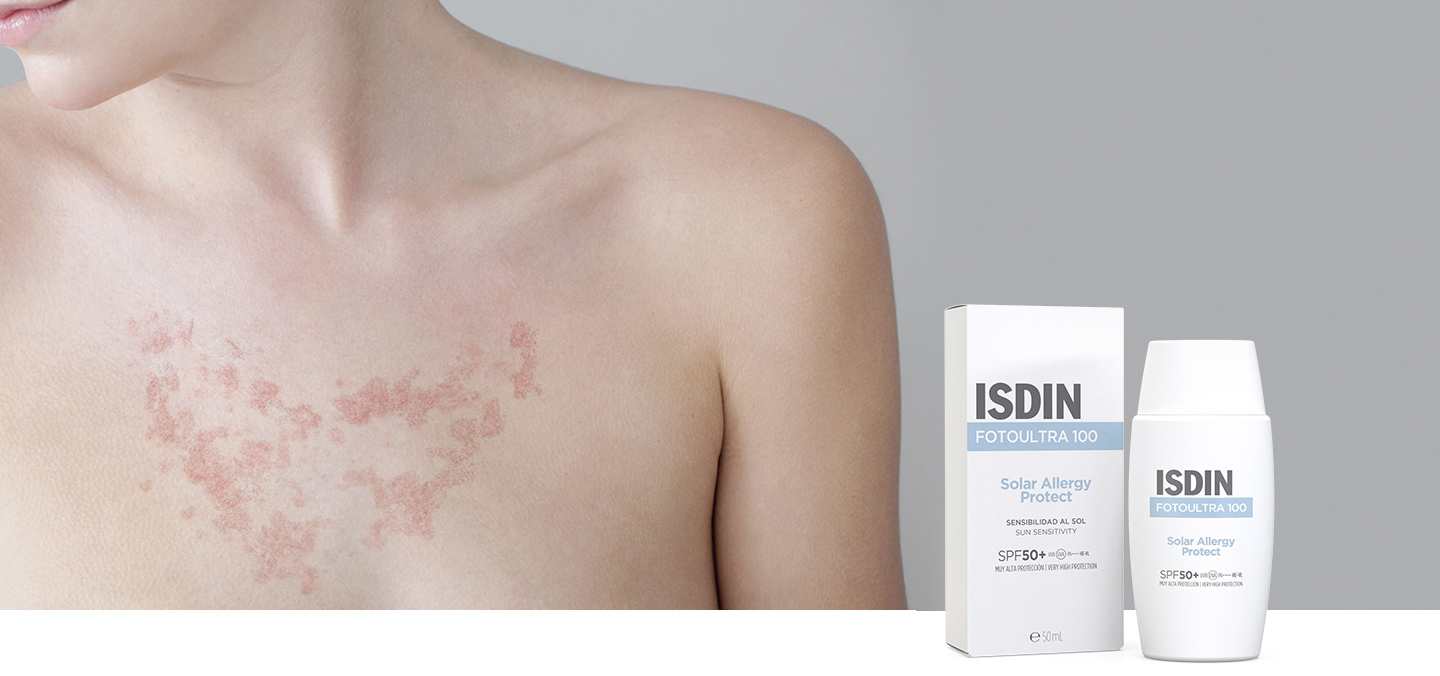 FotoUltra ISDIN Solar Allergy