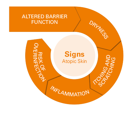 Atopic skin signs
