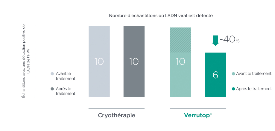 Estudio clínico: Verrutop reduce un 40% el DNA vírico mientras que la crioterapia no induce regresión