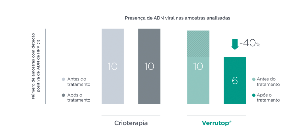 Estudio clínico: Verrutop reduce un 40% el DNA vírico mientras que la crioterapia no induce regresión