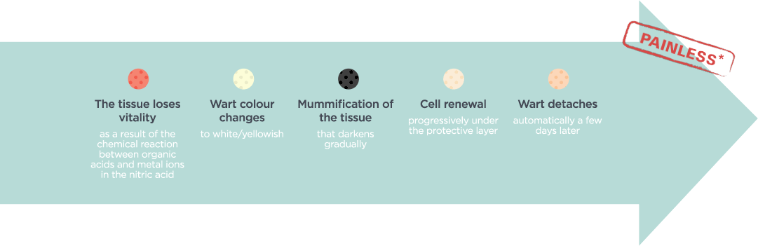 Topical painless and effective treatment of difficult warts