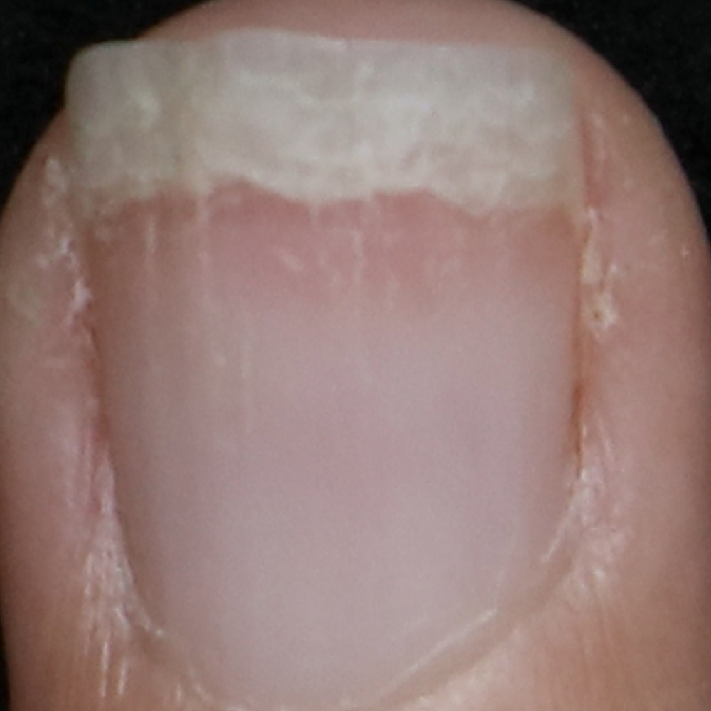 ISDIN SINAILS Fortalecedor de uñas ISDIN