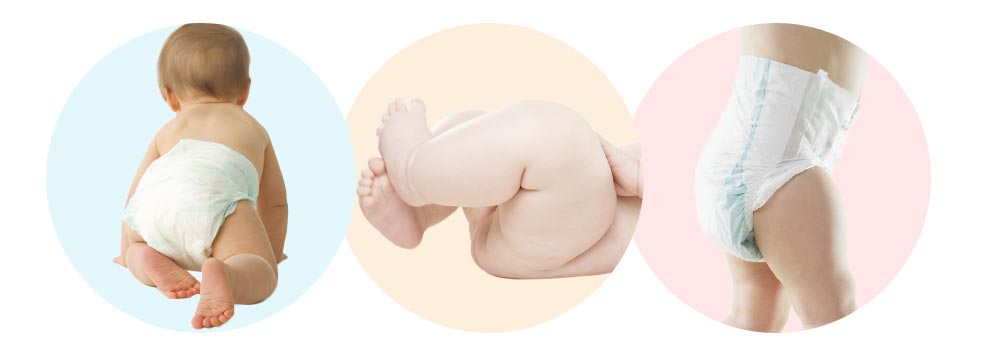 Nutraisdin previene y trata la dermatitis del pañal