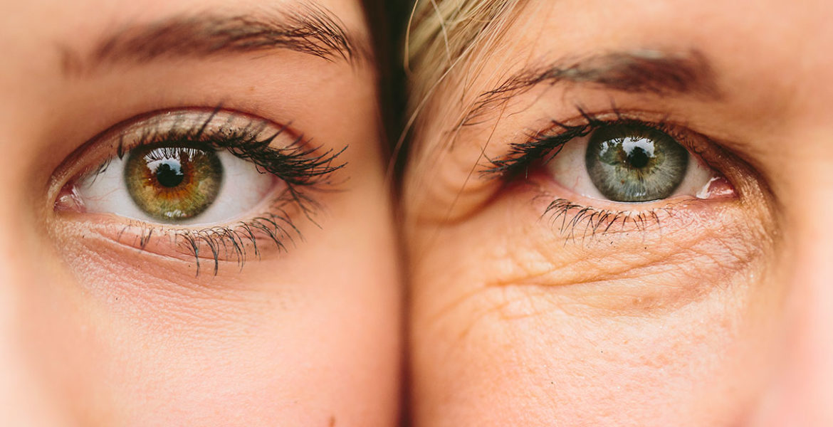 Qué Es El Fotoenvejecimiento Y Cómo Prevenirlo Isdin