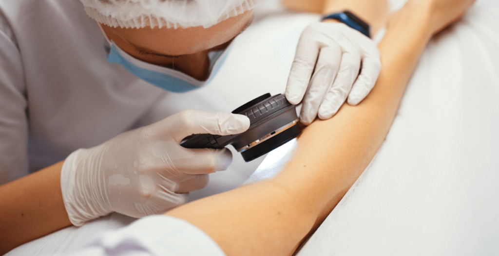 Acudir al dermatólogo