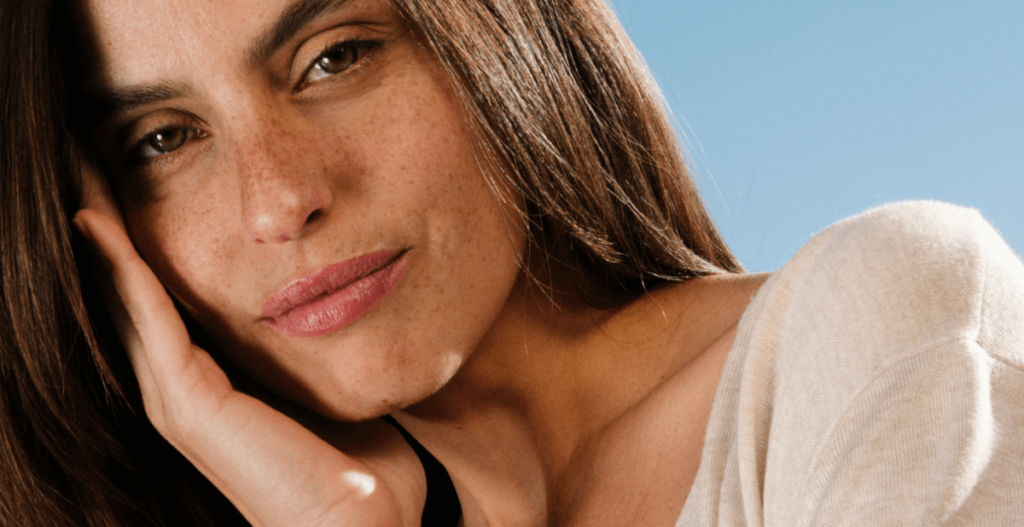 melasma gestacional