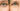 What is photoaging?