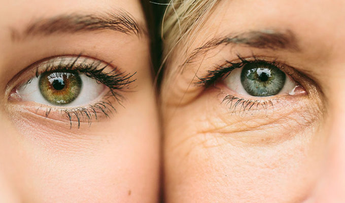 What is photoaging?
