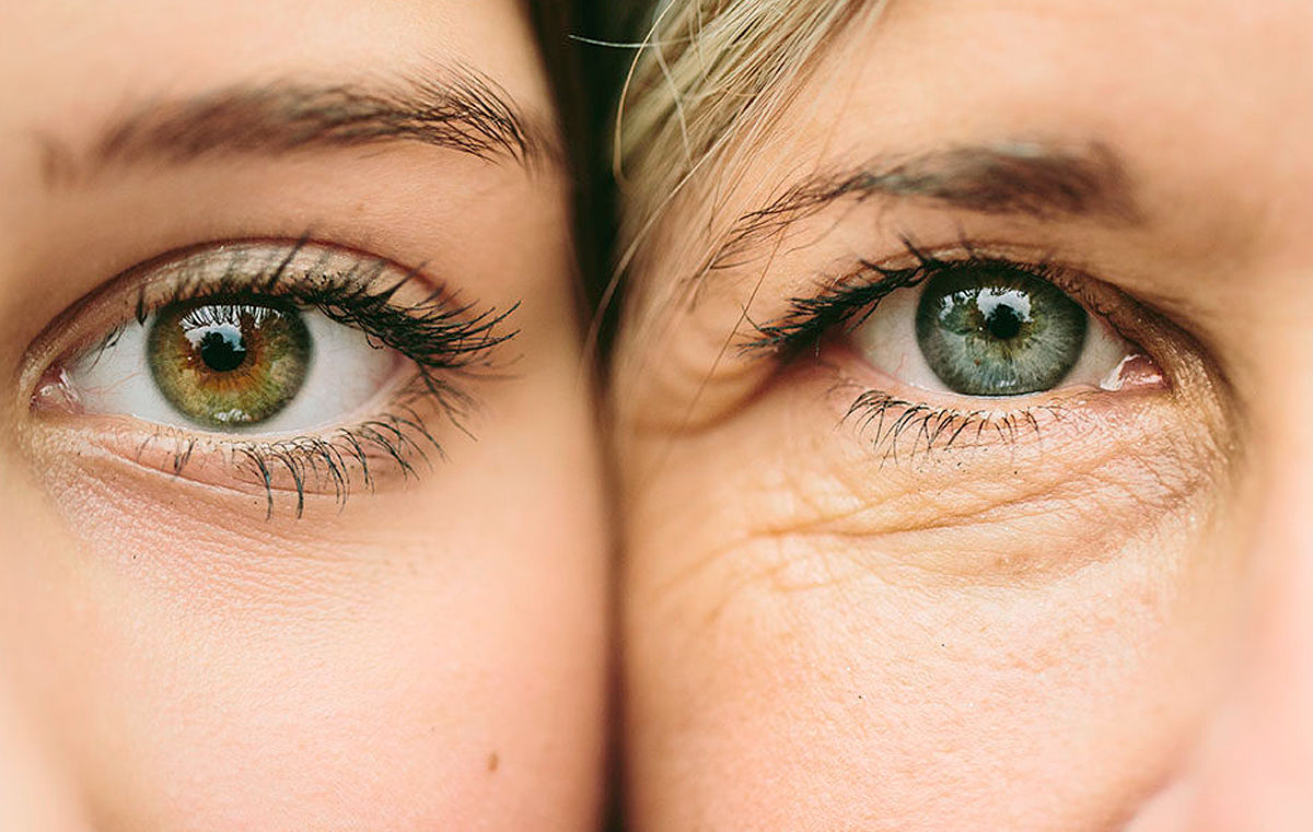 What is photoaging? Everything you need to know