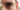 Bags under eyes in men ISDIN