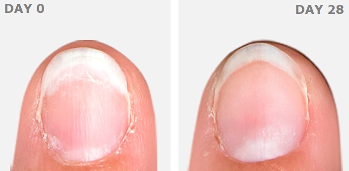 How to Repair Damaged and Split Nails | ISDIN