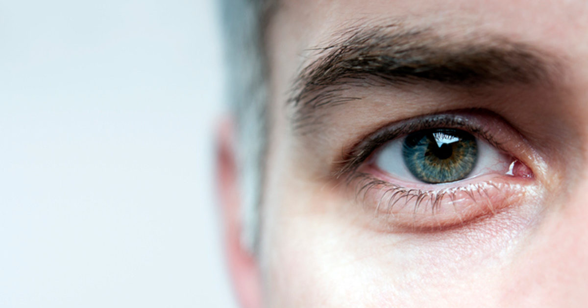 men's skin care eye bags