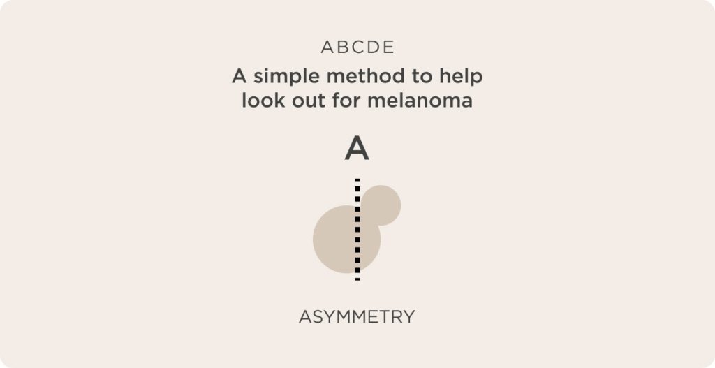 ABCDE Melanoma ISDIN