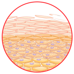 Capas de la piel - peeling
