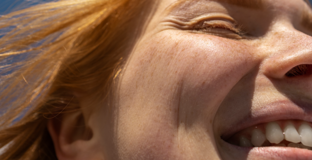 Rostro con pecas iluminado por el sol, ejemplo de piel que puede beneficiarse de ingredientes antimanchas como niacinamida, ácido tranexámico y vitamina C.
