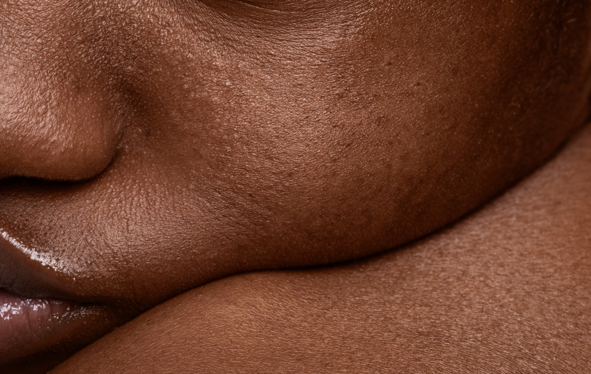 close up de piel