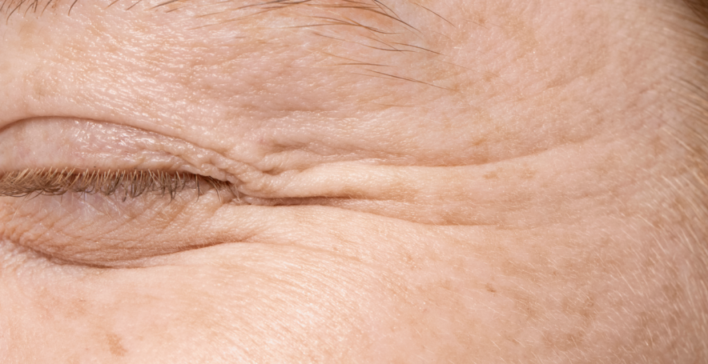 Primer plano del contorno de los ojos con líneas de expresión, patas de gallo y textura natural de la piel madura.