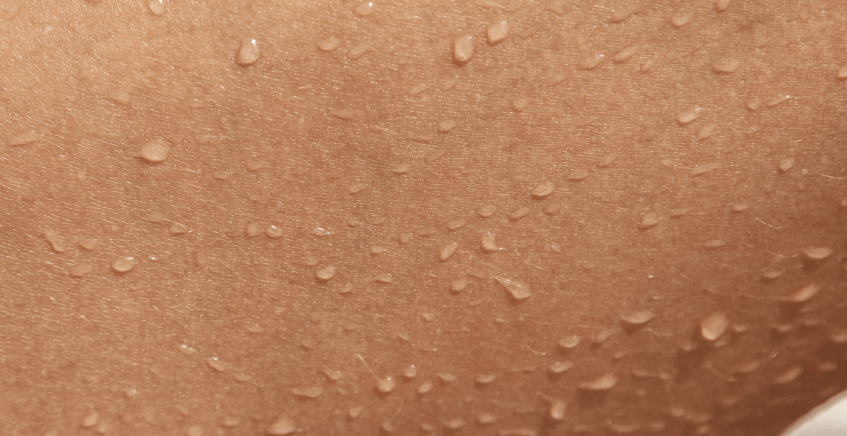¿Qué es la pérdida de agua transepidérmica (TEWL) y por qué afecta a tu ...