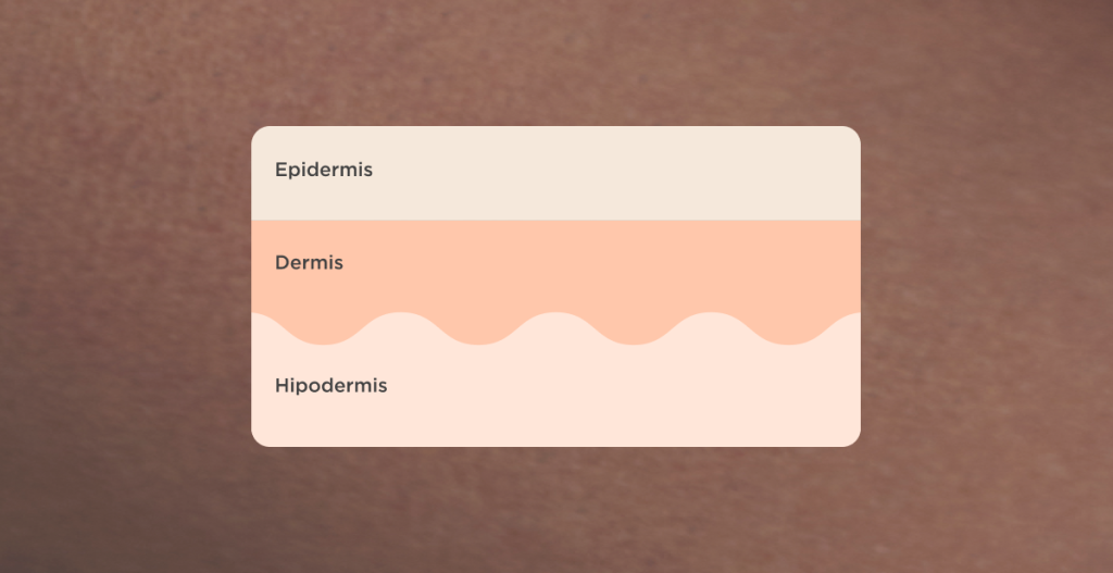 Ilustración de las capas de la piel: epidermis, dermis e hipodermis en diagrama simplificado