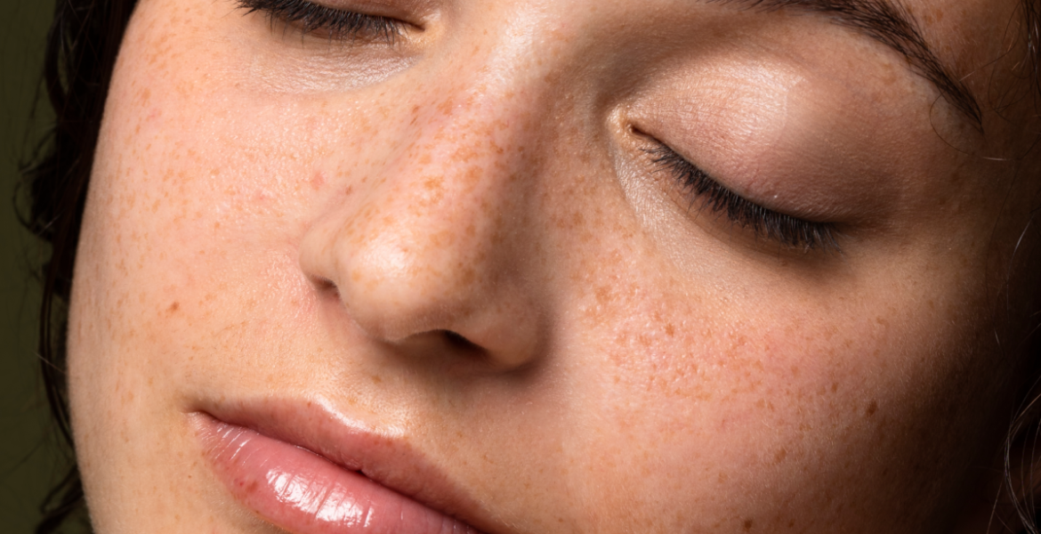 Rostro con pecas y piel natural saludable, ejemplo de diversidad cutánea y el rol protector de la barrera cutánea.