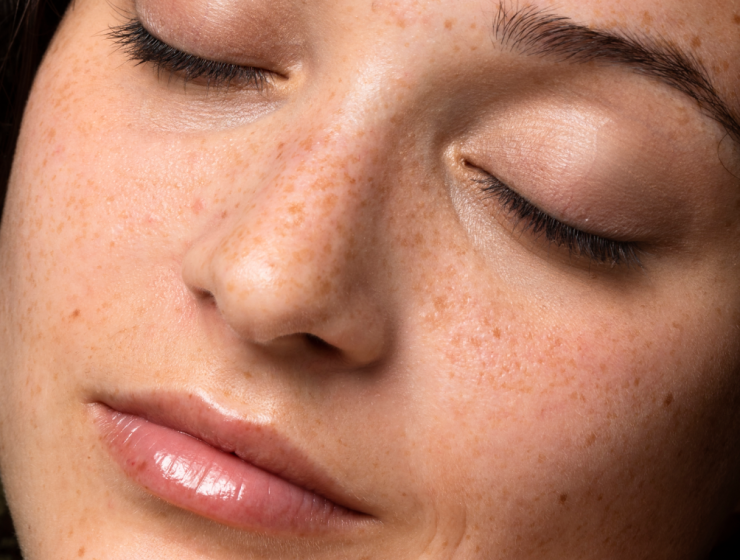 Rostro con pecas y piel natural saludable, ejemplo de diversidad cutánea y el rol protector de la barrera cutánea.