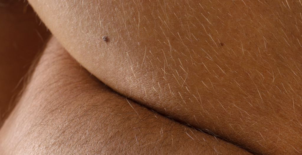 Detalle de piel corporal con vello fino y textura natural que refleja diversidad y características reales de la piel