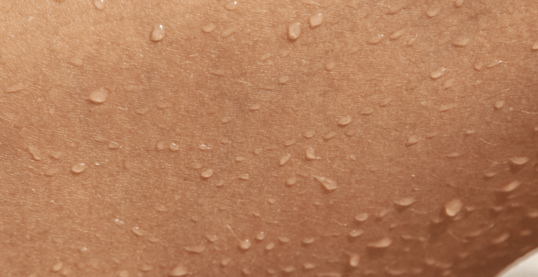 Piel hidratada con gotas de agua, ejemplo de una barrera cutánea sana y reforzada frente a la pérdida de agua transepidérmica.