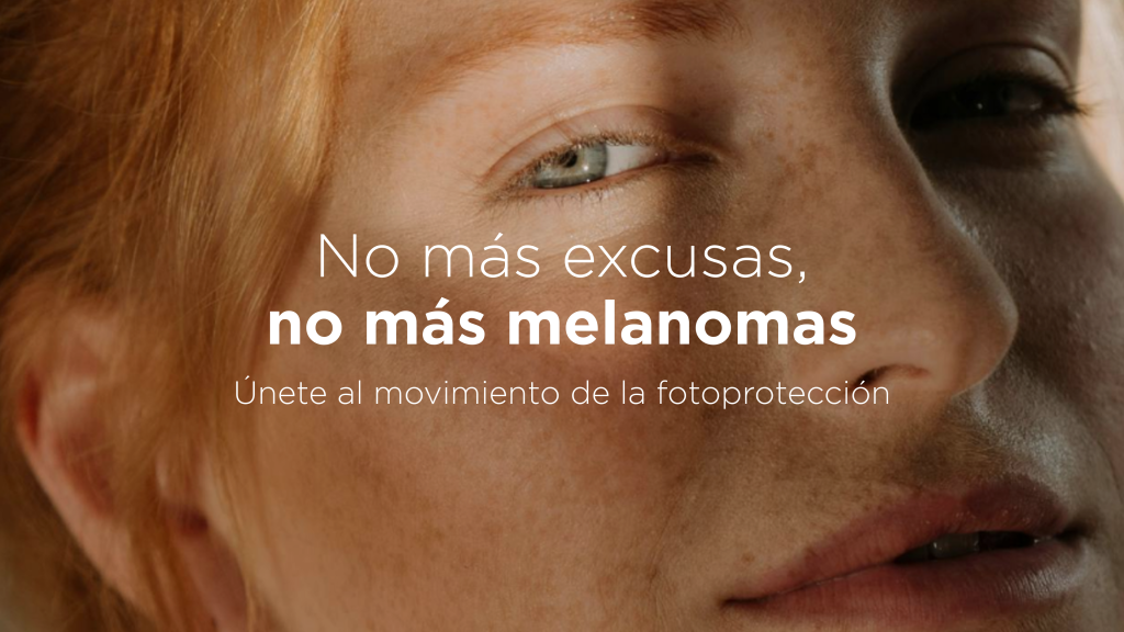 Rostro de mujer con el mensaje de campaña: no más excusas, no más melanomas.