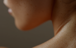 Rostro de mujer expuesto a la luz solar, relacionado con la prevención y detección temprana del melanoma.