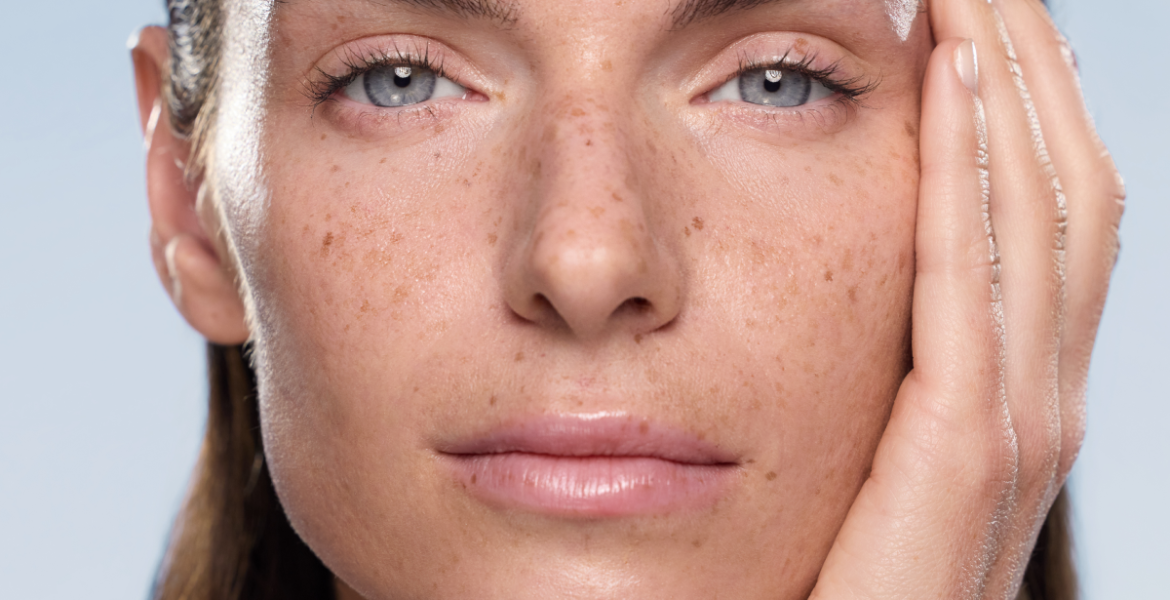 primer plano de chica con ojos azules y zona del contorno de ojos muy cuidada