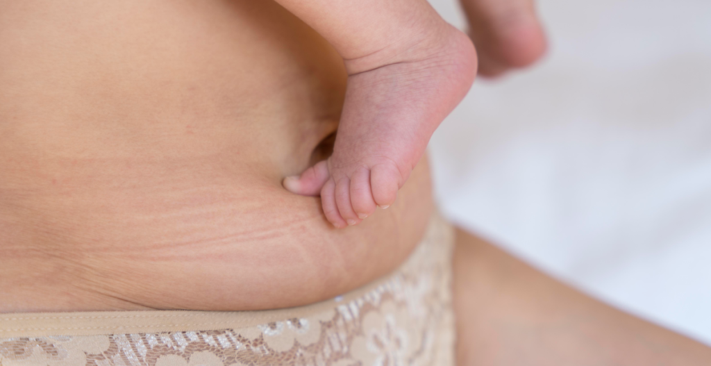 cuidado corporal posparto barriga de mamá
