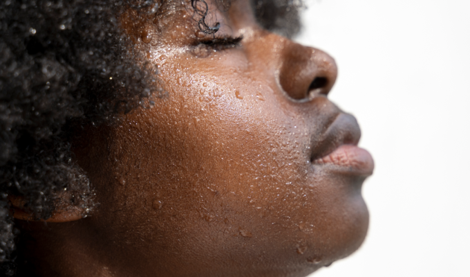 representación de NMF en piel oscura