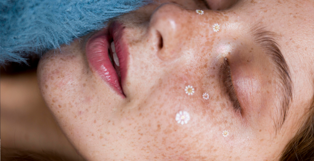 Close-up de piel con muchas pecas y divertidas stickers para la piel. Reflejo de un skincare bien cuidado para dejar mitos atrás.
