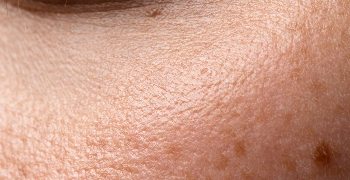 T: Detalle de la textura natural de la piel con pequeñas manchas y líneas finas.