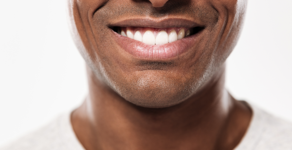 Sonrisa con dientes blancos y sanos tras una rutina de higiene bucodental completa