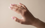 Mano con gotas de sudor, imagen principal sobre hiperhidrosis en manos y pies.