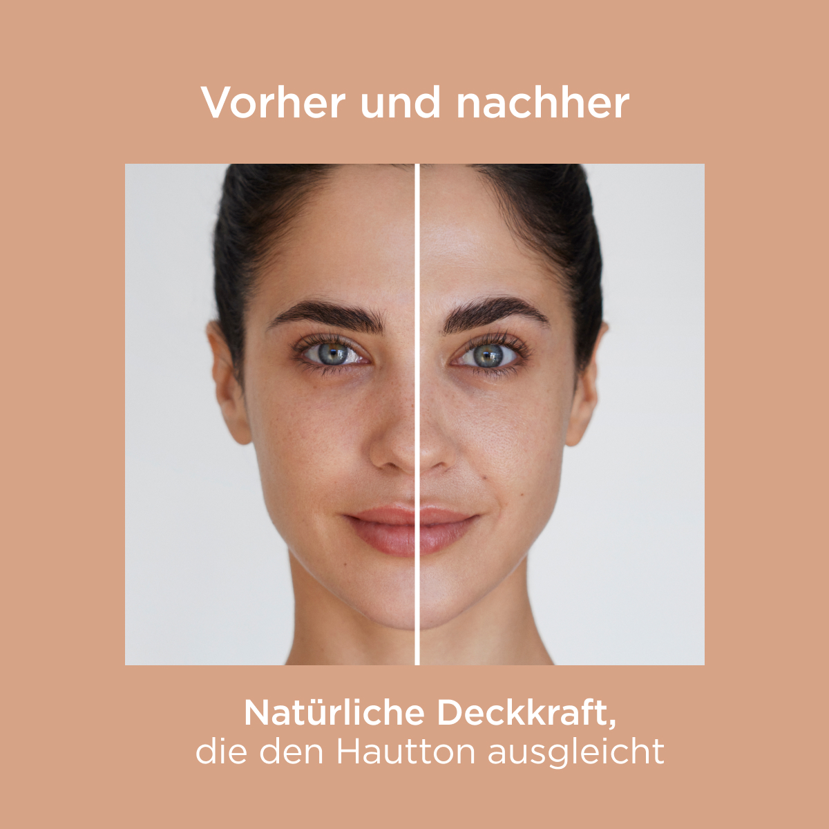 Fotoprotection