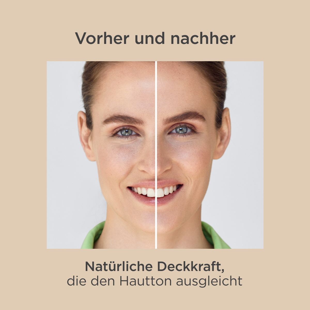 Fotoprotection