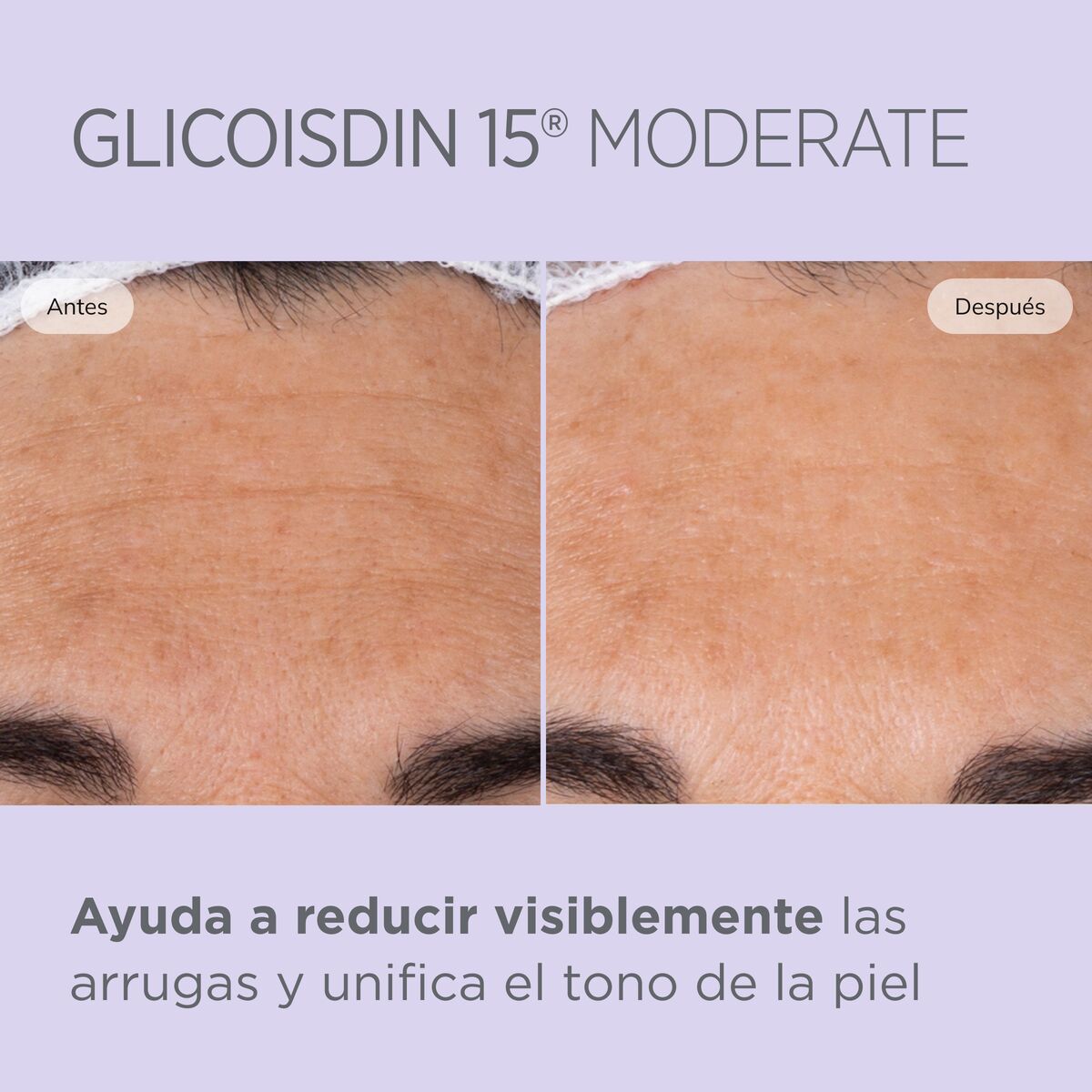 Isdinceutics
