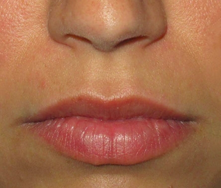 ISDIN reparador labial fluido con acido hialuronico. protege y repara los  labios, la nariz y la zona perioral, textura fluida y ligera, 10ml, 0.28