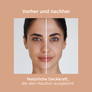 Fotoprotection
