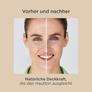 Fotoprotection