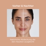 Fotoprotector