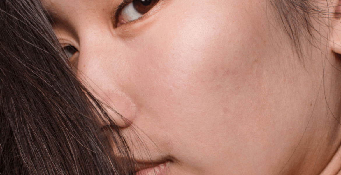 Understanding Pigmentation: What You Really Need to Know